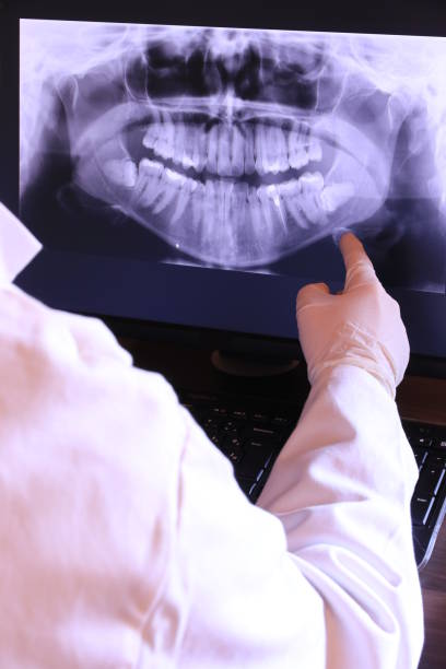 Best Emergency Root Canal Treatment in Silver Grove, KY