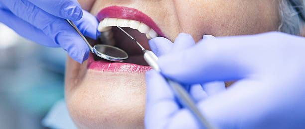 Best Emergency Dental Care for Broken or Chipped Teeth in Silver Grove, KY